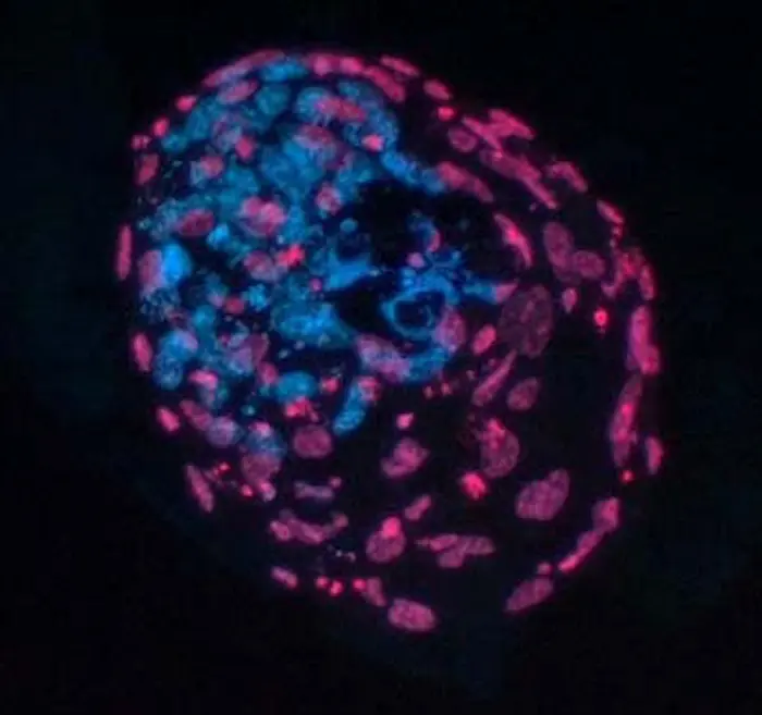 tinciones diferenciales