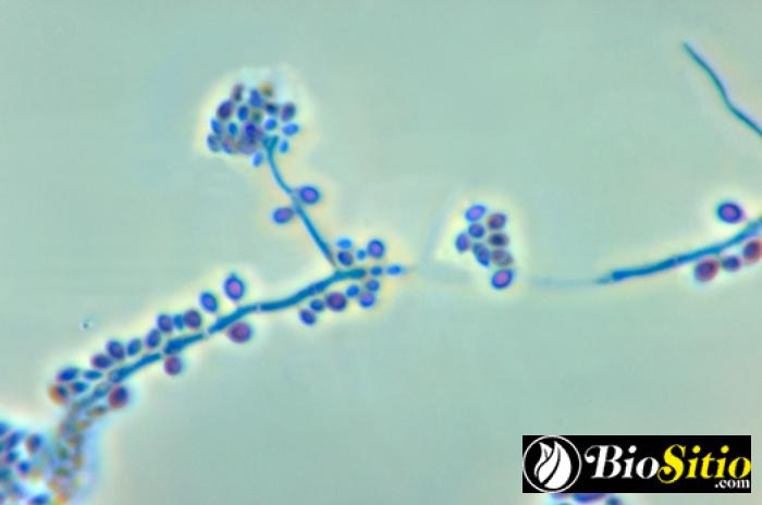 Sporothrix Schenckii